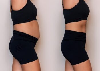 Common Digestive Disorders: Natural Approaches to IBS, Bloating & More