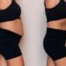 Common Digestive Disorders: Natural Approaches to IBS, Bloating & More