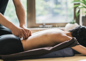 Getting Started with Acupuncture: What to Expect & Potential Benefits